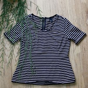H&M Striped Peplum Top